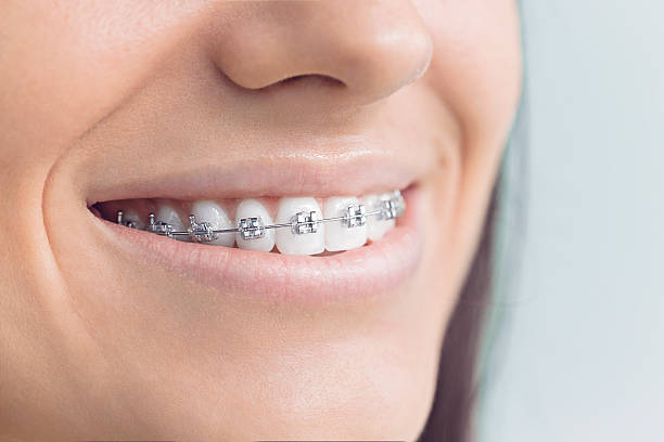 Best Traditional Braces  in Teviston, CA
